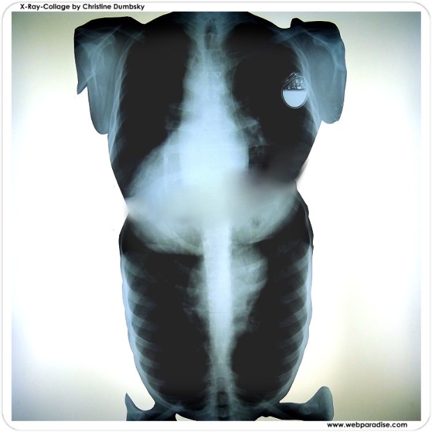x-ray-artwork-webparadise-brustkorb-frau-mann-herzschrittmacher-frauen-herz-im-mann